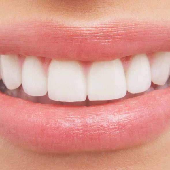 Smile-04.jpg Bright healthy smile after professional dental care